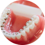 Lingual_ortodonti Lingual_ortodonti